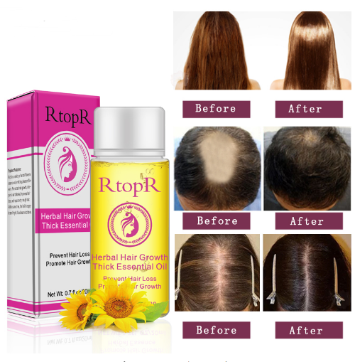 Manage Hair Loss with Fast Powerful Essential Oil Hair Care Products Liquid Treatment - 20ml