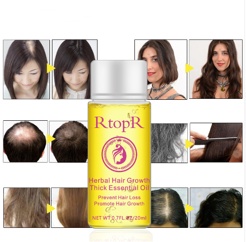 Manage Hair Loss with Fast Powerful Essential Oil Hair Care Products Liquid Treatment - 20ml