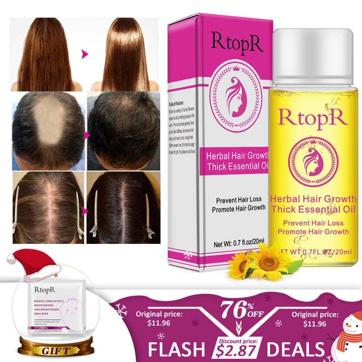 Manage Hair Loss with Fast Powerful Essential Oil Hair Care Products Liquid Treatment - 20ml