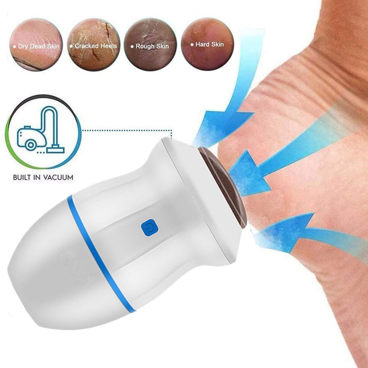 Electric Vacuum Foot Scraper -Exfoliate Dead Skin Calluses, Heel Scraper