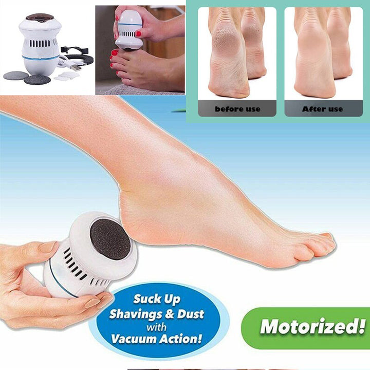 Electric Vacuum Foot Scraper -Exfoliate Dead Skin Calluses, Heel Scraper