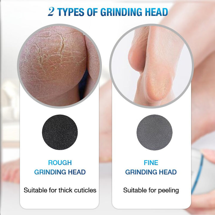 Electric Vacuum Foot Scraper -Exfoliate Dead Skin Calluses, Heel Scraper